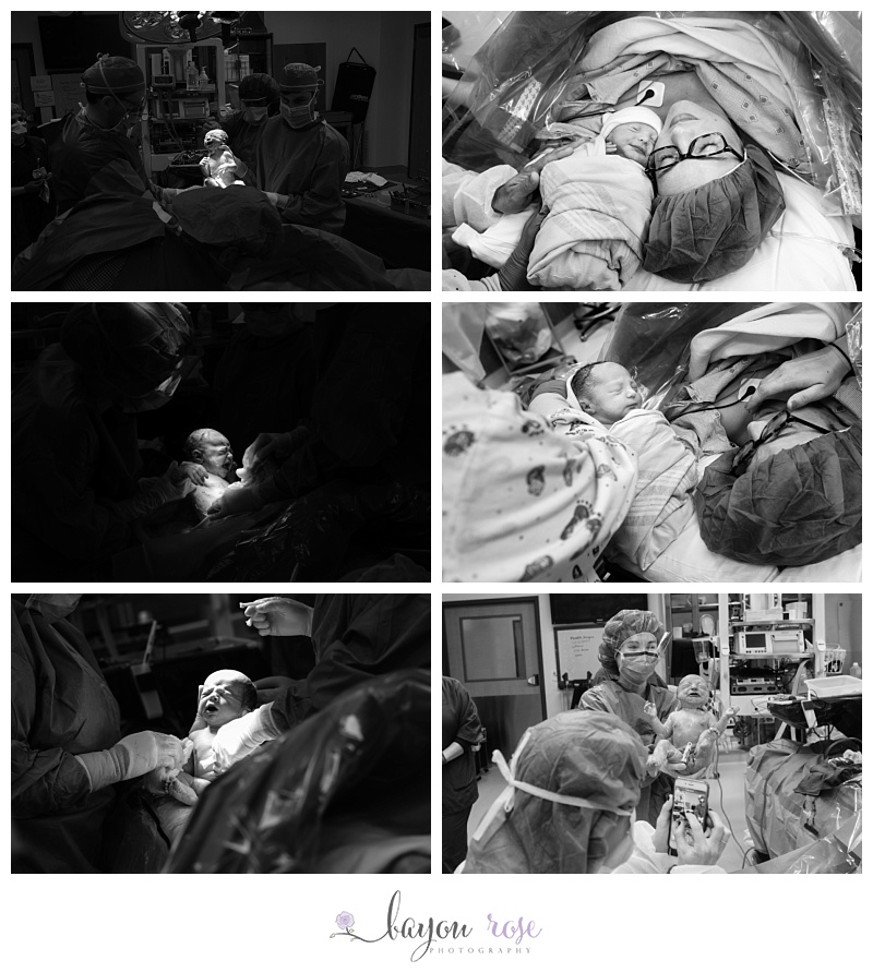 photographing your c-section birth